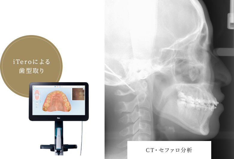 CT・セファロ分析