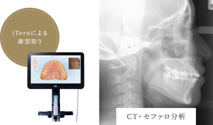 CT・セファロ分析